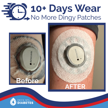 CHAOS Multi-Color Reusable GripShield® Compatible with Dexcom G7™/Stelo™ | Bump Protector | Reusable CGM Bump Protection