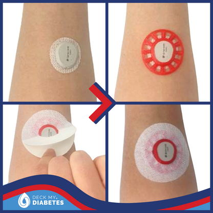 3-Pack Combo- Reusable GripShield®  Compatible with Dexcom G7™/Stelo™| Bump Protector