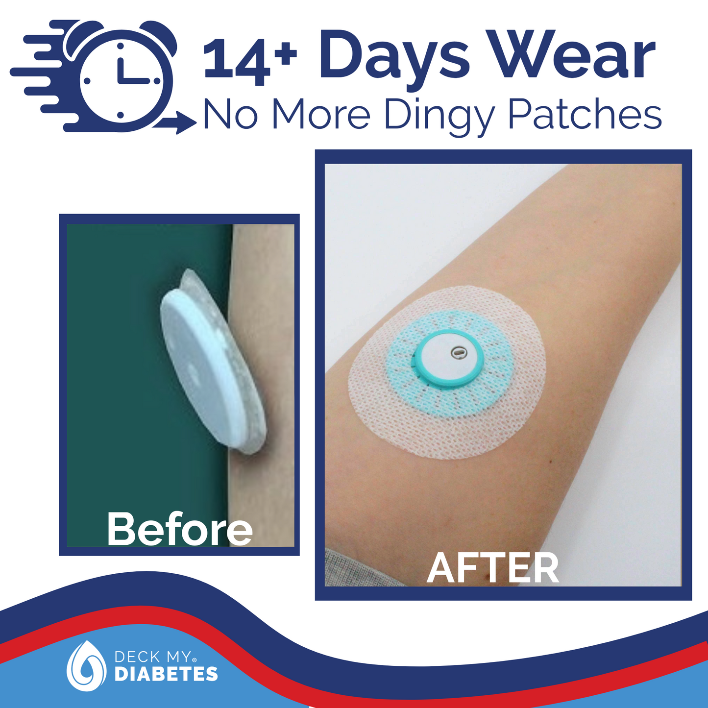 GripShield® Compatible with Libre® 3, Libre® 3 Plus & Minimed Instinct® – 3-Pack Combo | Select 3 Colors & Save!