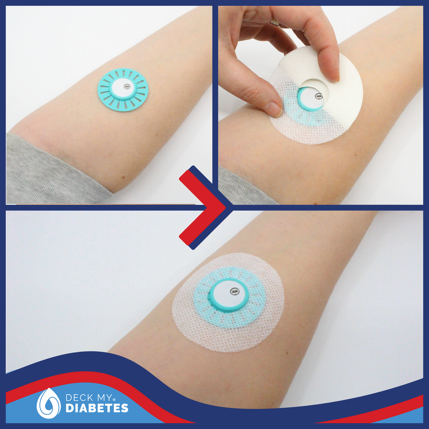 Reusable GripShield® Compatible with Libre® 2+